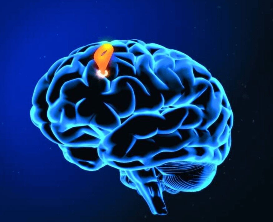 Transcranial Magnetic Stimulation (TMS)