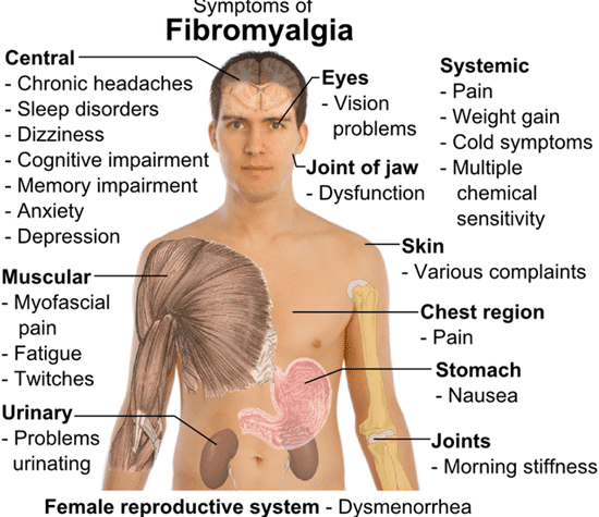 Treating_Fibro